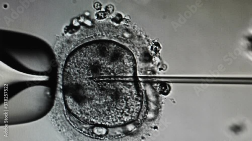 Intracytoplasmic sperm injection. Microscope view of in vitro fertilization. embryologist performing Sperm Injection, ivf icsi. 4 k video