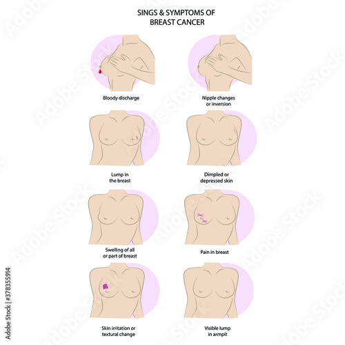 breast cancer symptoms, vector icons in flat style