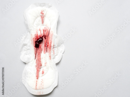 Obraz na plátně Symptom of endometriosis, menstrual blood with blood clots on a sanitary pad