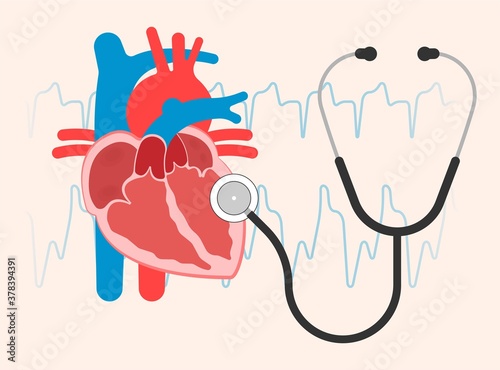 Cath Lab Atrial Septal Defect Tetralogy of Fallot Patent Foramen Ovale Mitral Valve Stenosis Heart Attack Ductus Arteriosus Doppler Coronary Artery Disease Congestive Congenital Valvular VSD exam leak