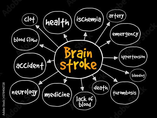 Brain stroke mind map, medical concept for presentations and reports