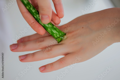 Female hand applying aloe vera gel on a skin burn. Natural alternative medicine.Healthy lifestyle. Nature products for beauty. Eco concept