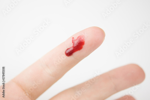 Bleeding from the cut finger