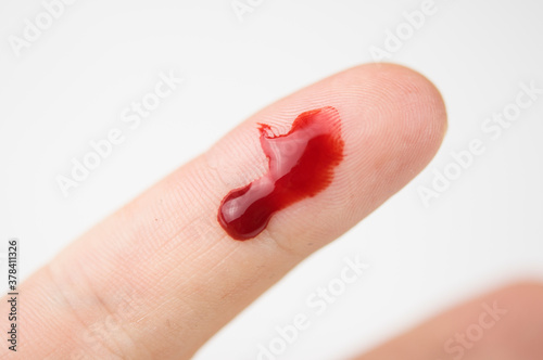 Fényképezés Bleeding from the cut finger