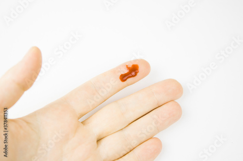 Bleeding from the cut finger