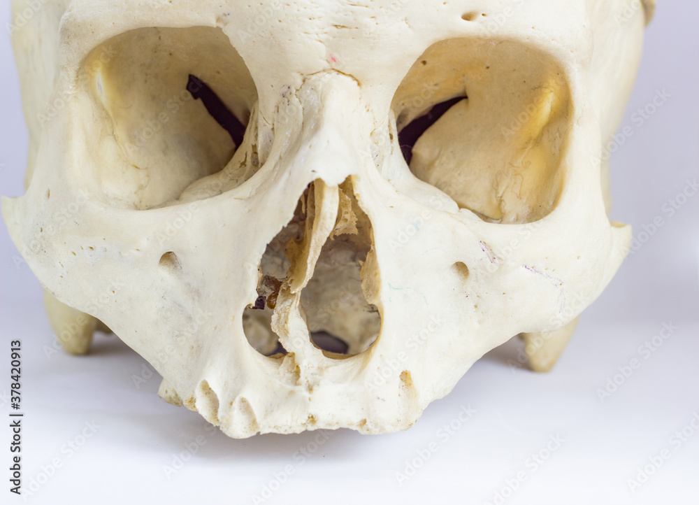 close up macro view of human skull bone showing the anatomy of nasal foramen, nasal septum and orbital cavity close up macro view of human skull bone showing the anatomy of nasal foramen, nasal septum and orbital cavity