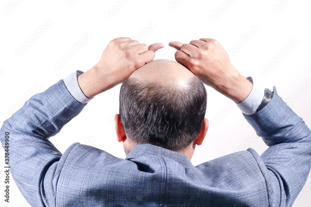 bald businessman with his head on scalp view from behind with white background bald businessman with his head on scalp view from behind with white background
