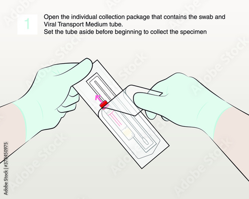 Step 1 : Open the individual collection package that contains the swab and Viral Transport Medium tube.