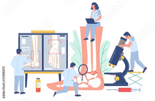 Ankle and foot arthritis. Tiny doctor characters examining human foot joints using microscope, magnifier, xray pictures, flat vector illustration. Osteoarthritis, rheumatoid arthritis, joint disease.