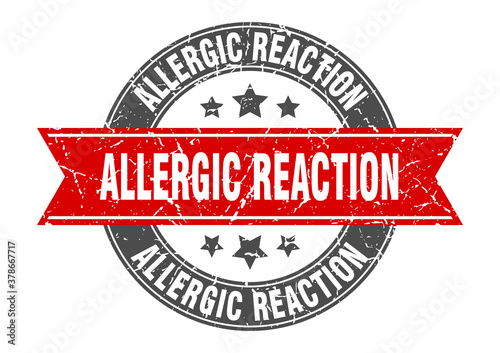 allergic reaction round stamp with ribbon. label sign