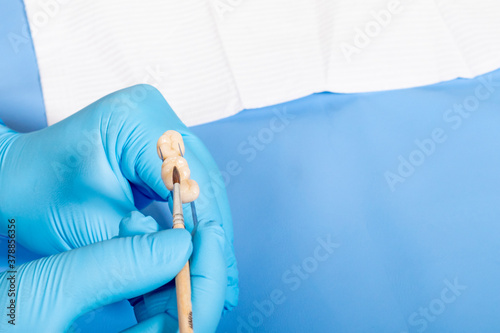 medical equipment. Making a denture. The doctor holds a crown in his hands and covers it with a special compound. photo