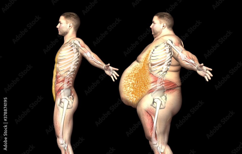 representación 3D. La grasa se acumula en el abdomen, tanto