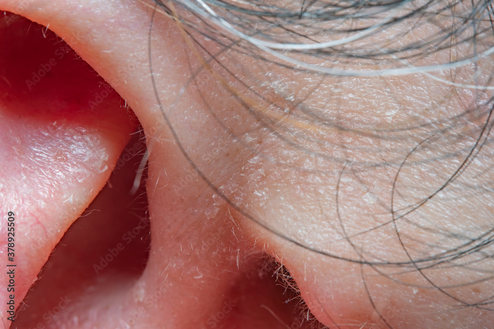 Fototapeta premium Close-up of part of the male ear in soft focus with strong magnification under the microscope. Concept - Hearing Preservation and Health Care
