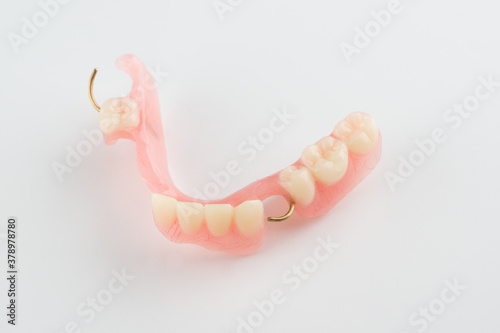 acrylic dental prosthesis