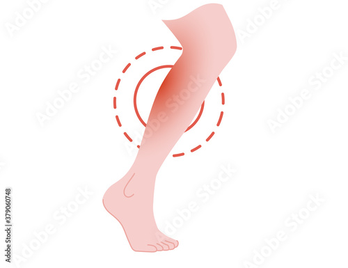 Painful leg concept with pain red circle cartoon flat design vector illustration on white background
