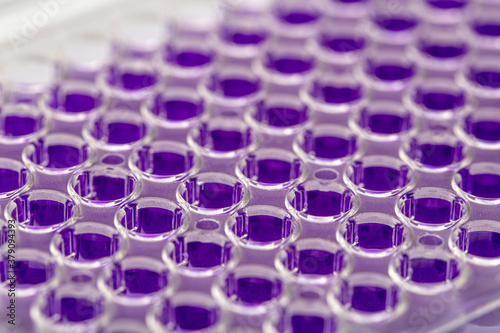 Multi channel pipette loading biological samples in microplate for test in the laboratory / Multichannel pipette load samples in pcr microplate with 96 wells photo