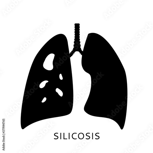 Silicosis disease design template, lung disease. Medicine and healthcare concept. Vector illustration for web and mobile