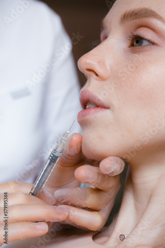 Syringe for injection at the lips of a girl. Cosmological procedure. Cosmetic medicine, beauty injections concept