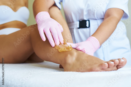 Cosmetologist is applying epilation paste. The hair removal procedure.