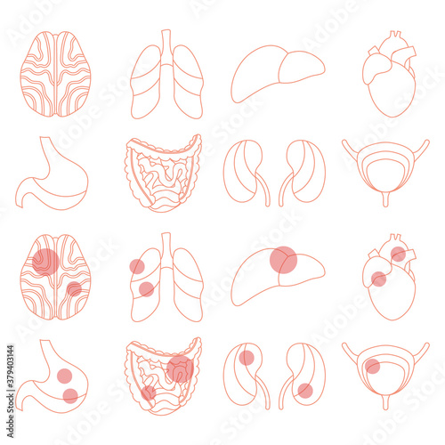 Healthy and unhealthy internal human organs. Brain, lungs, liver, heart, stomach, intestines, kidneys, bladder. Vector line illustration. Perfect for flyer, medical brochure, banner