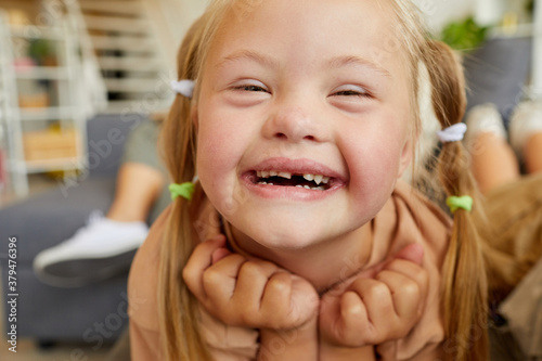 Close up portrait of blonde girl with down syndrome smiling happily looking at camera while lying on sofa at home photo