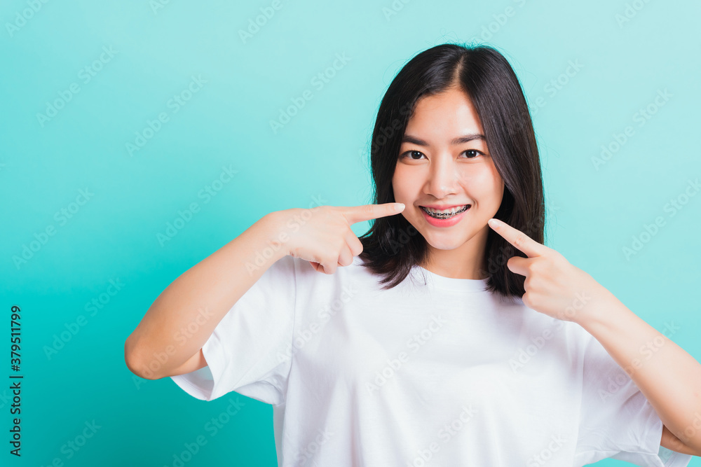 Fototapeta premium Portrait of Asian teen beautiful young woman smile have dental braces on teeth laughing point finger her mouth, studio shot isolated on a blue background, Medicine and dentistry concept