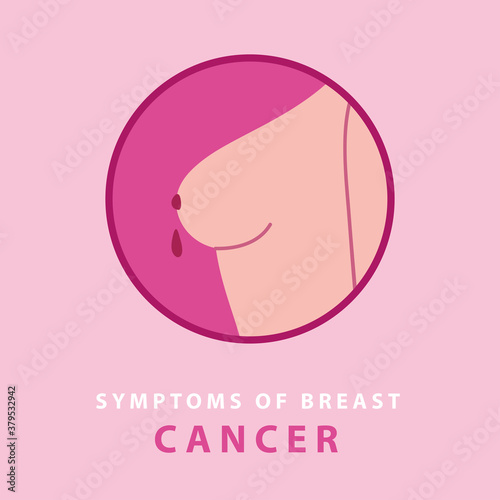 symptoms of breast cancer, nipple discharge