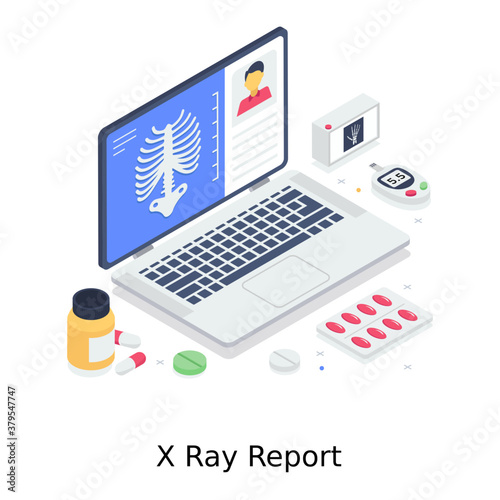 
X ray report illustration design, isometric vector 
