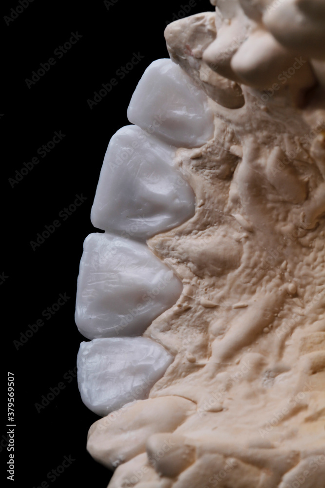 Teeth wax mockup seen from inside