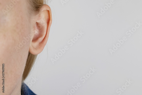 Darwin's tubercle on the ear. The girl at the reception at the plastic surgeon, shows the auricle. photo