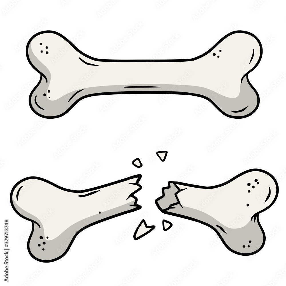 Fototapeta premium Bone fracture. Trauma to the body. Crack and splinters. Dangerous situation and wound. Cartoon flat illustration and dog toy isolated on white background