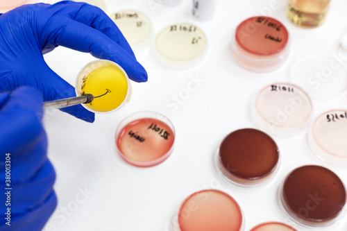 Lab technician taking a sample of urine to be placed on an agar plate for testing