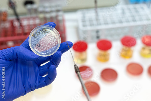 Hand of a lab technician holding petri dish with a sample for candida