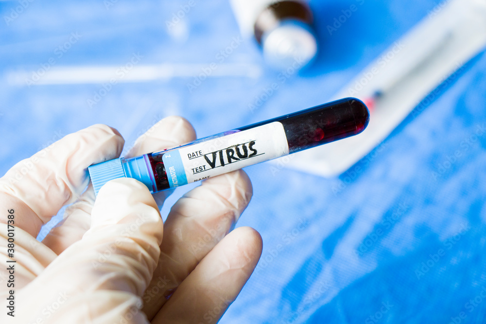 Obraz premium virus blood test tube in laboratory, glassware and reagents