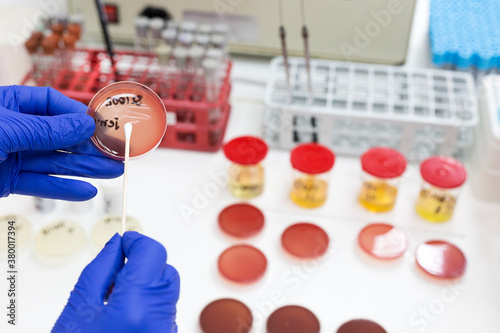 Lab technician putting a sample on an agar plate for testing photo