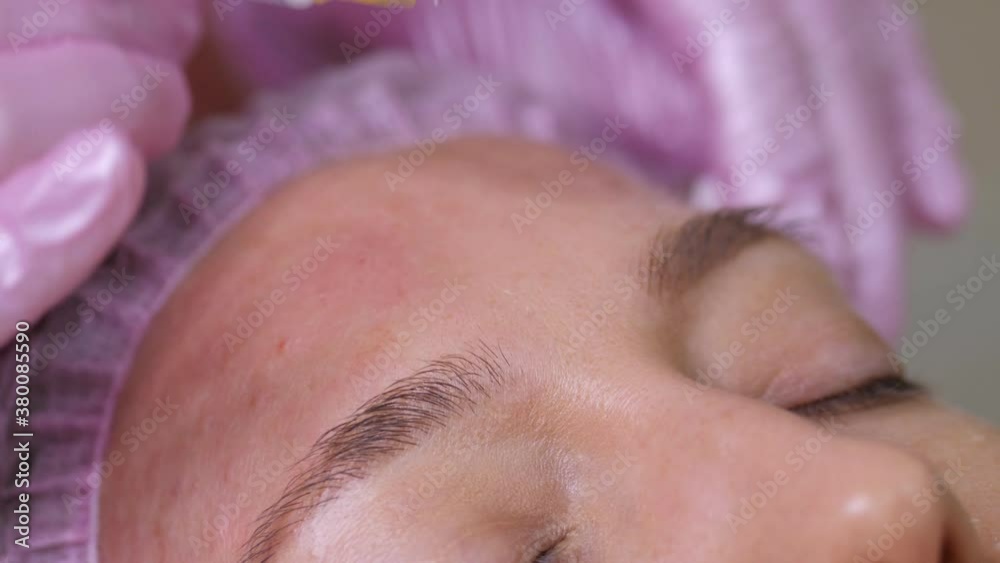 Cosmetologist makes the Rejuvenating facial injections procedure for tightening and smoothing wrinkles on the face skin of young woman in a beauty salon Cosmetologist makes the Rejuvenating facial injections procedure for tightening and smoothing wrinkles on the face skin of young woman in a beauty salon