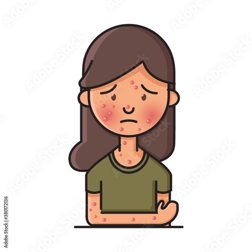 Woman with chickenpox