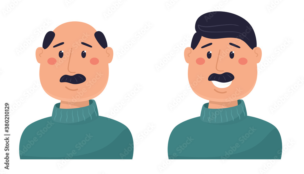 A man with hair and balding. Vector illustration in flat style. A man with hair and balding. Vector illustration in flat style.