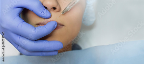 Close up of lips augmentation procedure on a young woman done by a cosmetologist doctor with Hyaluronic acid Injection.