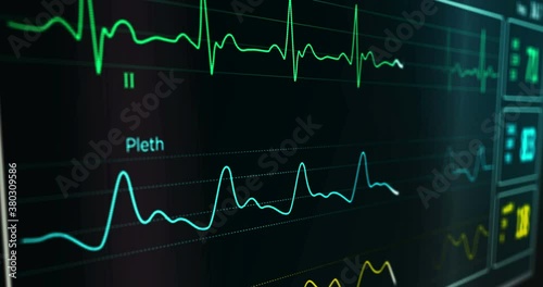 ECG heart beat rate cardio monitor in hospital. EKG electrocardiogram, respiration and SPO2 oxygen saturation medical examination. Patient cardiac monitoring. Heartbeat display loopable seamless anima