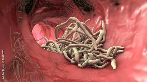 Parasitic worms in the lumen of intestine photo