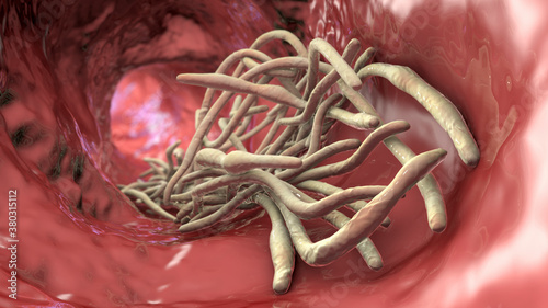 Fototapeta Naklejka Na Ścianę i Meble -  Parasitic worms in the lumen of intestine