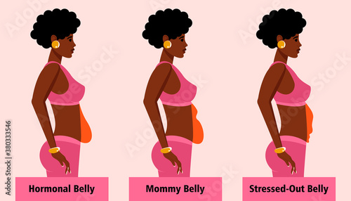 Types of female tummies for African American women. Menopausal hormonal belly, bloating belly and stressed-out belly. Vector illustration