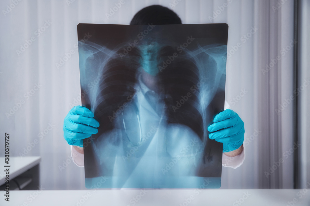 Foto de A doctor is diagnosing the results of the lung X-rays of ...