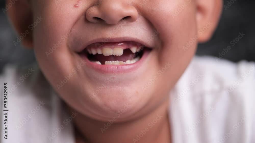 The mouth of an Asian boy laughing with pleasure. The mouth of an Asian boy laughing with pleasure.