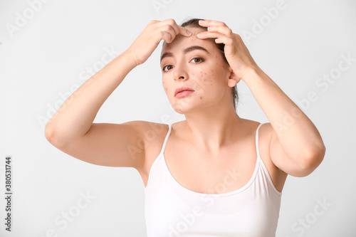 Young woman with acne problem squishing pimples on white background