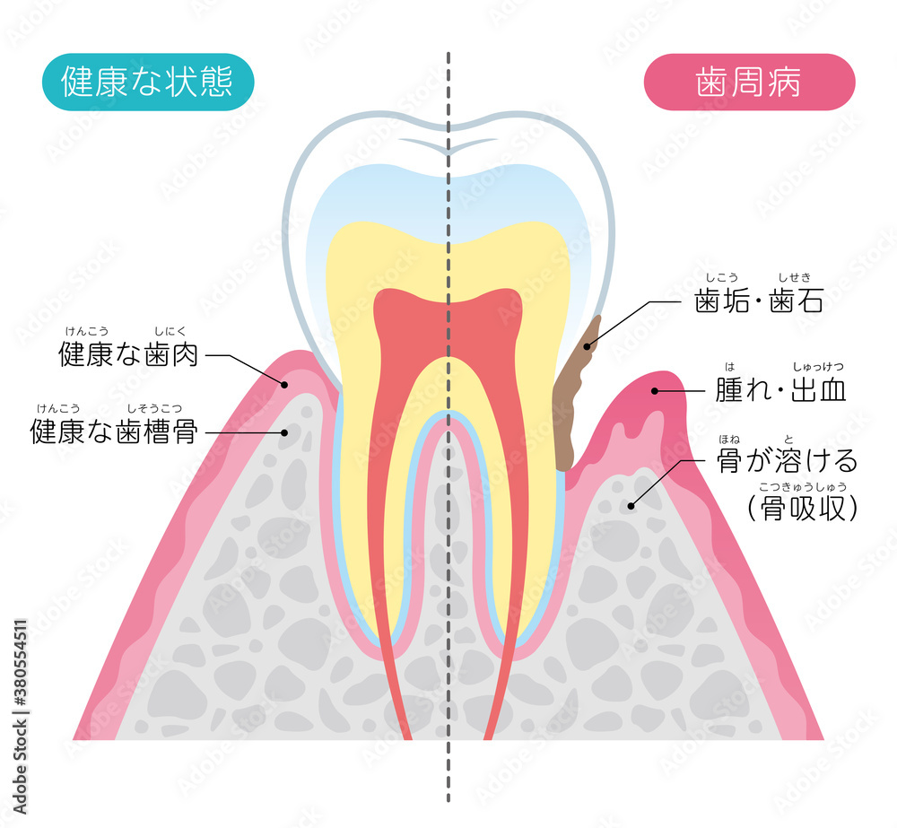 Tooth cross section_12