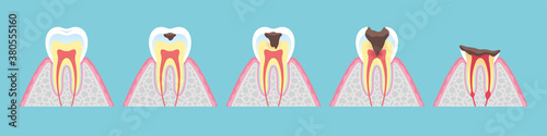 Tooth cross section_10