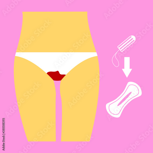 Menstruation in women, pads and tampons on a pink background, for design, vector illustration