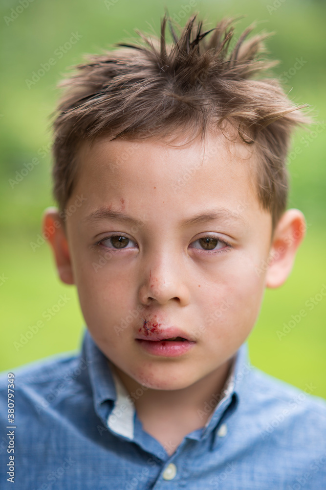 Poor Little Injured Boy Poor Little Injured Boy